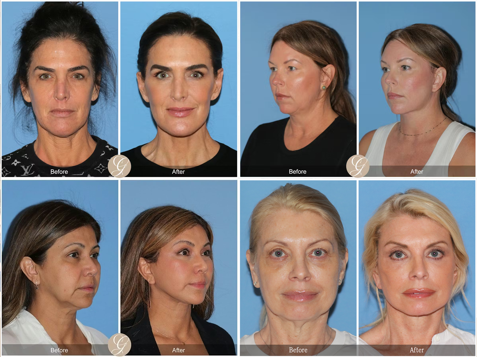 Different before and after photos