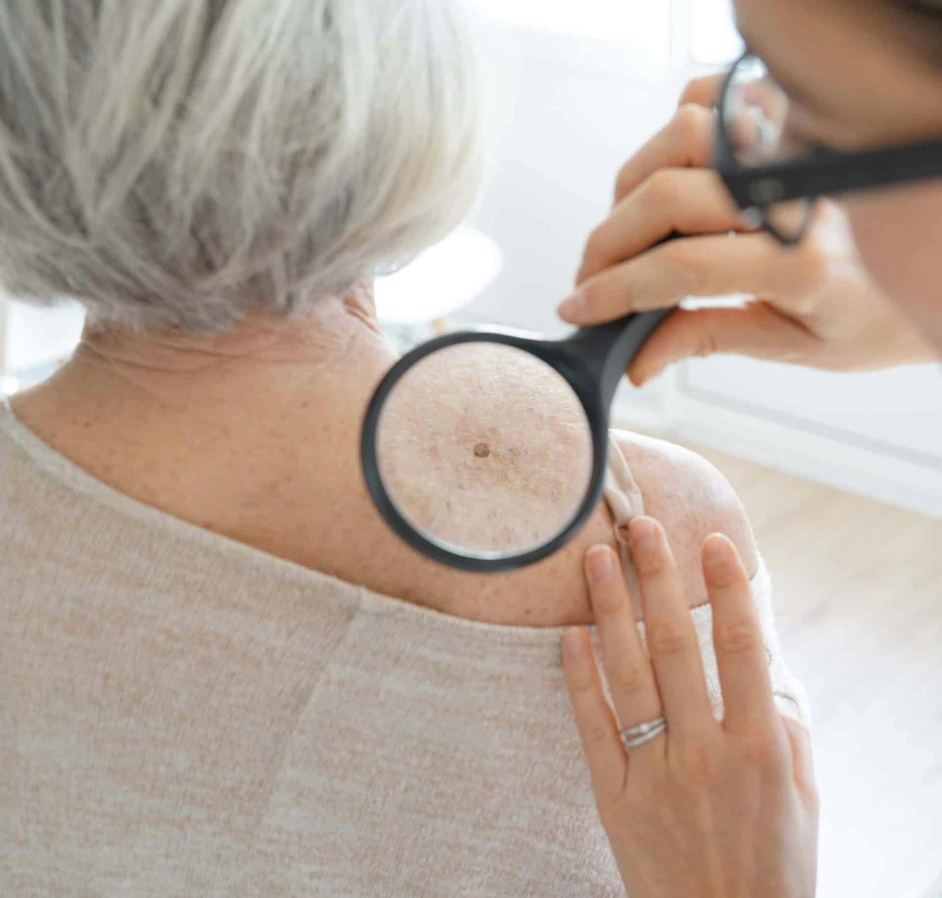 woman receiving facial