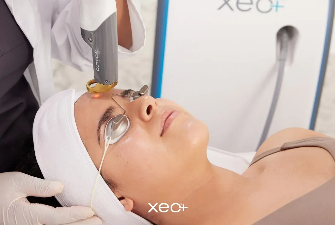 Laser Genesis treatment at Elevate Dermatology
