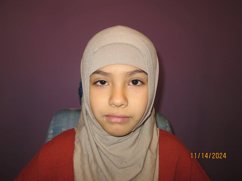 Ptosis Before & After Gallery - Patient 426278 - Image 1
