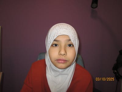 Ptosis Before & After Gallery - Patient 426278 - Image 2