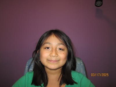 Complex Strabismus Before & After Gallery - Patient 402010 - Image 2