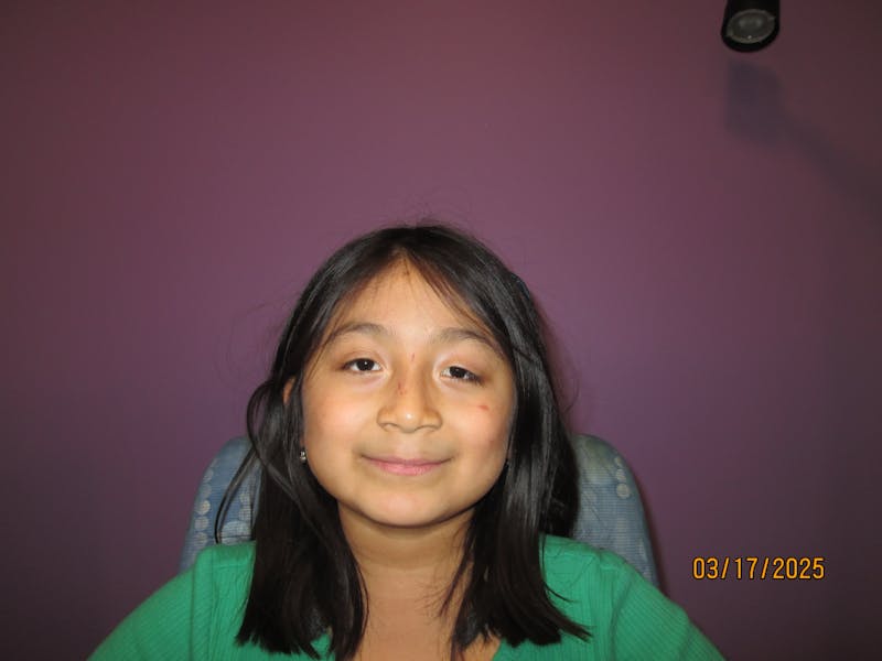 Complex Strabismus Before & After Gallery - Patient 402010 - Image 2