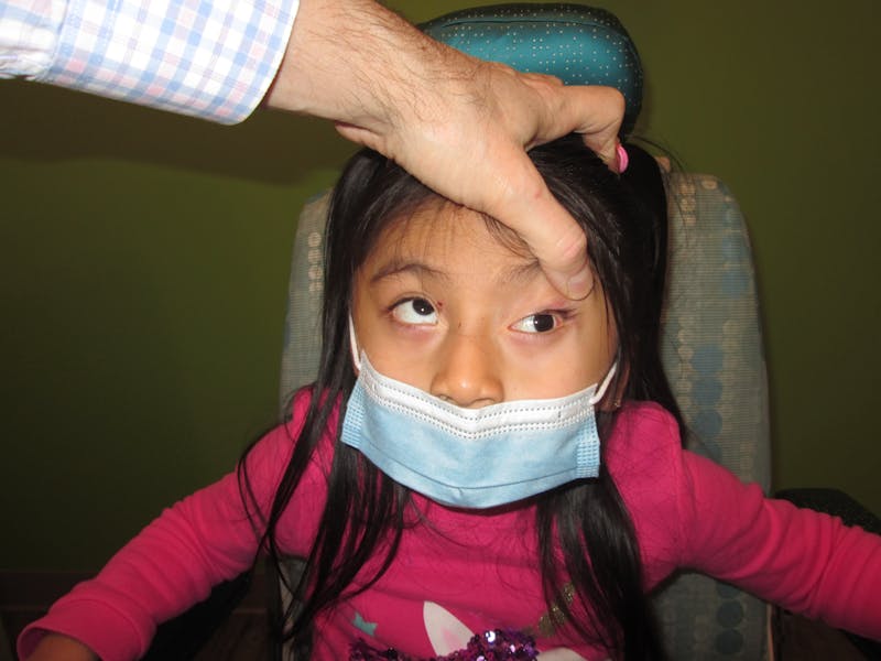 Complex Strabismus Before & After Gallery - Patient 402010 - Image 3