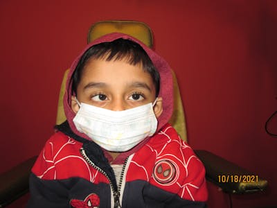 Esotropia Before & After Gallery - Patient 513762 - Image 1