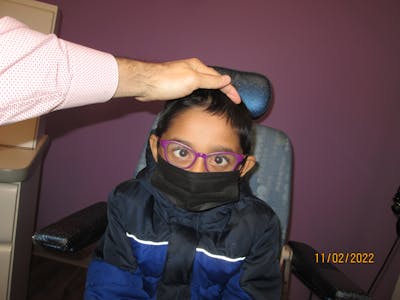 Esotropia Before & After Gallery - Patient 513762 - Image 2