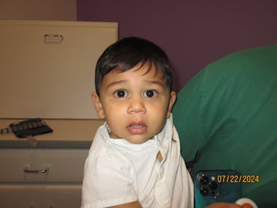 Esotropia Before & After Gallery - Patient 343873 - Image 2
