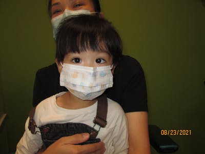 Esotropia Before & After Gallery - Patient 975150 - Image 1