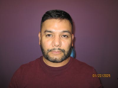 Exotropia Before & After Gallery - Patient 221772 - Image 1