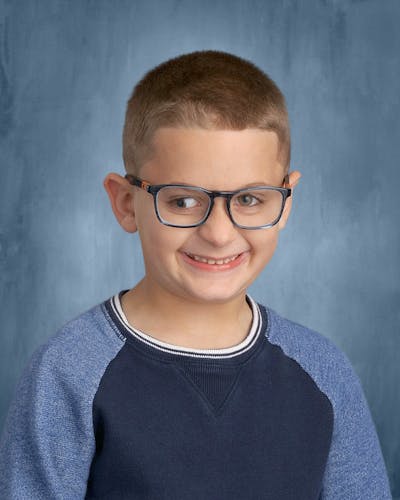 Exotropia Before & After Gallery - Patient 393784 - Image 1