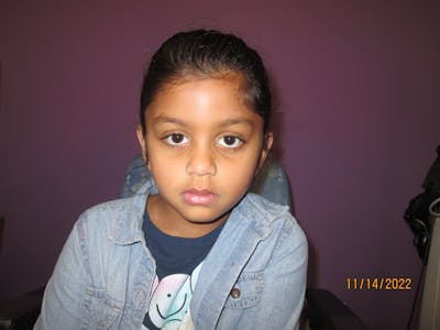 Exotropia Before & After Gallery - Patient 251727 - Image 2