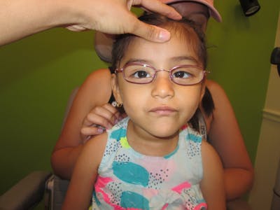 Esotropia Before & After Gallery - Patient 268169 - Image 1