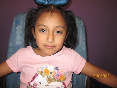 Ptosis Before & After Gallery - Patient 343768 - Image 1