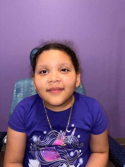 Exotropia Before & After Gallery - Patient 111297 - Image 2
