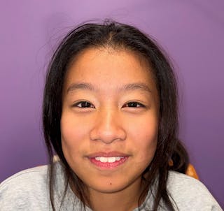 Esotropia Before & After Gallery - Patient 662544 - Image 2