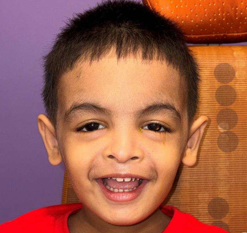 Ptosis Before & After Gallery - Patient 121703 - Image 2