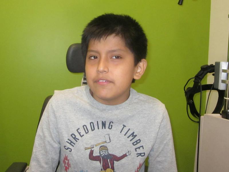 Nystagmus Before & After Gallery - Patient 213180 - Image 1