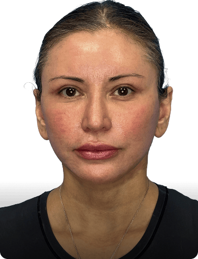After image of a woman