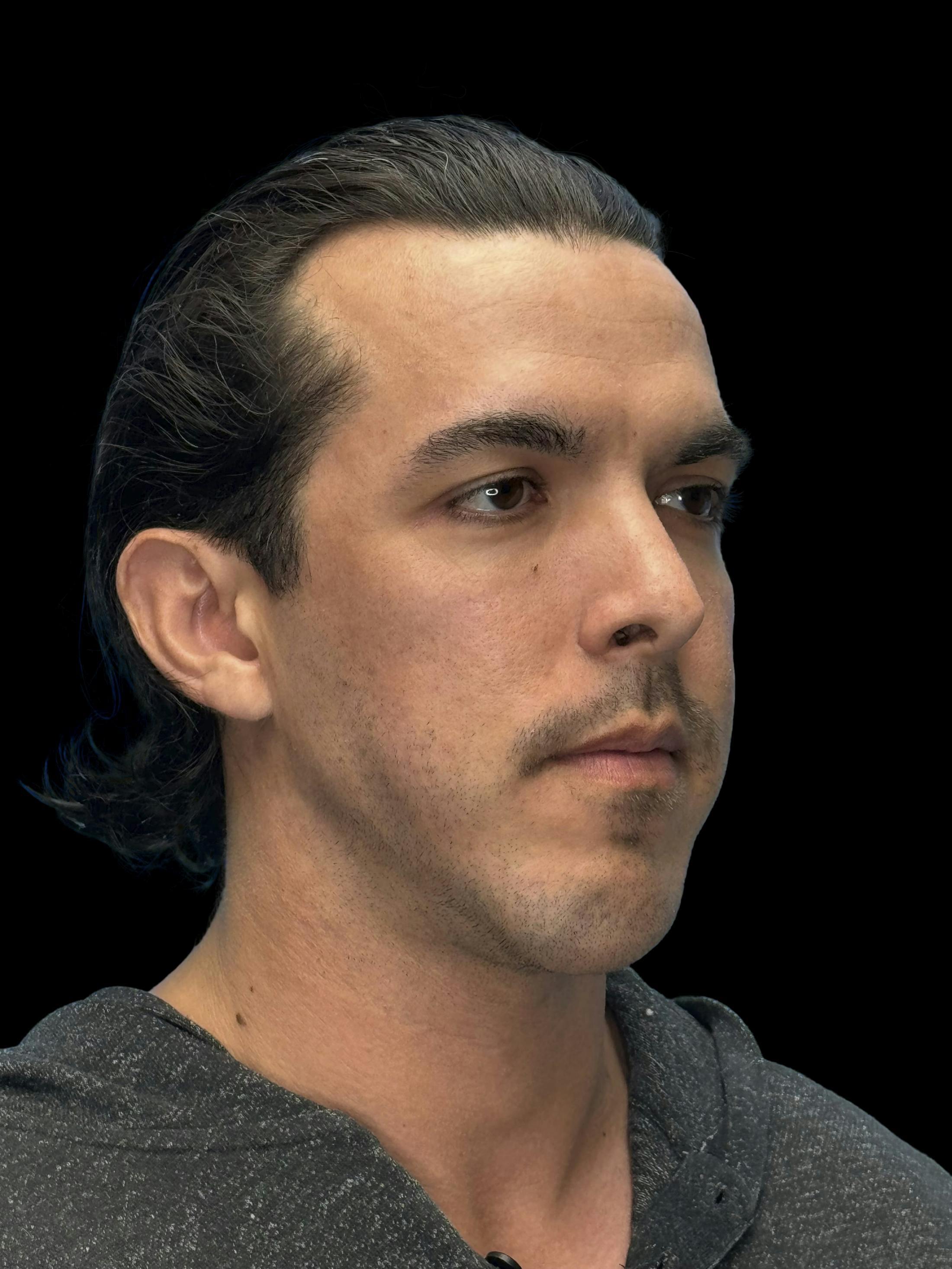 Before image of a man