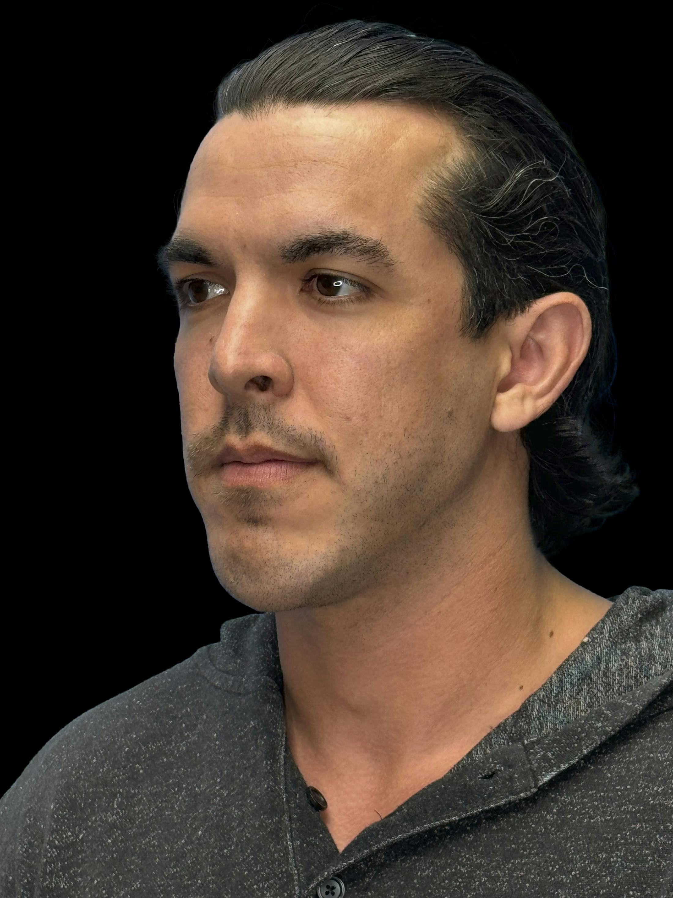 Before image of a man