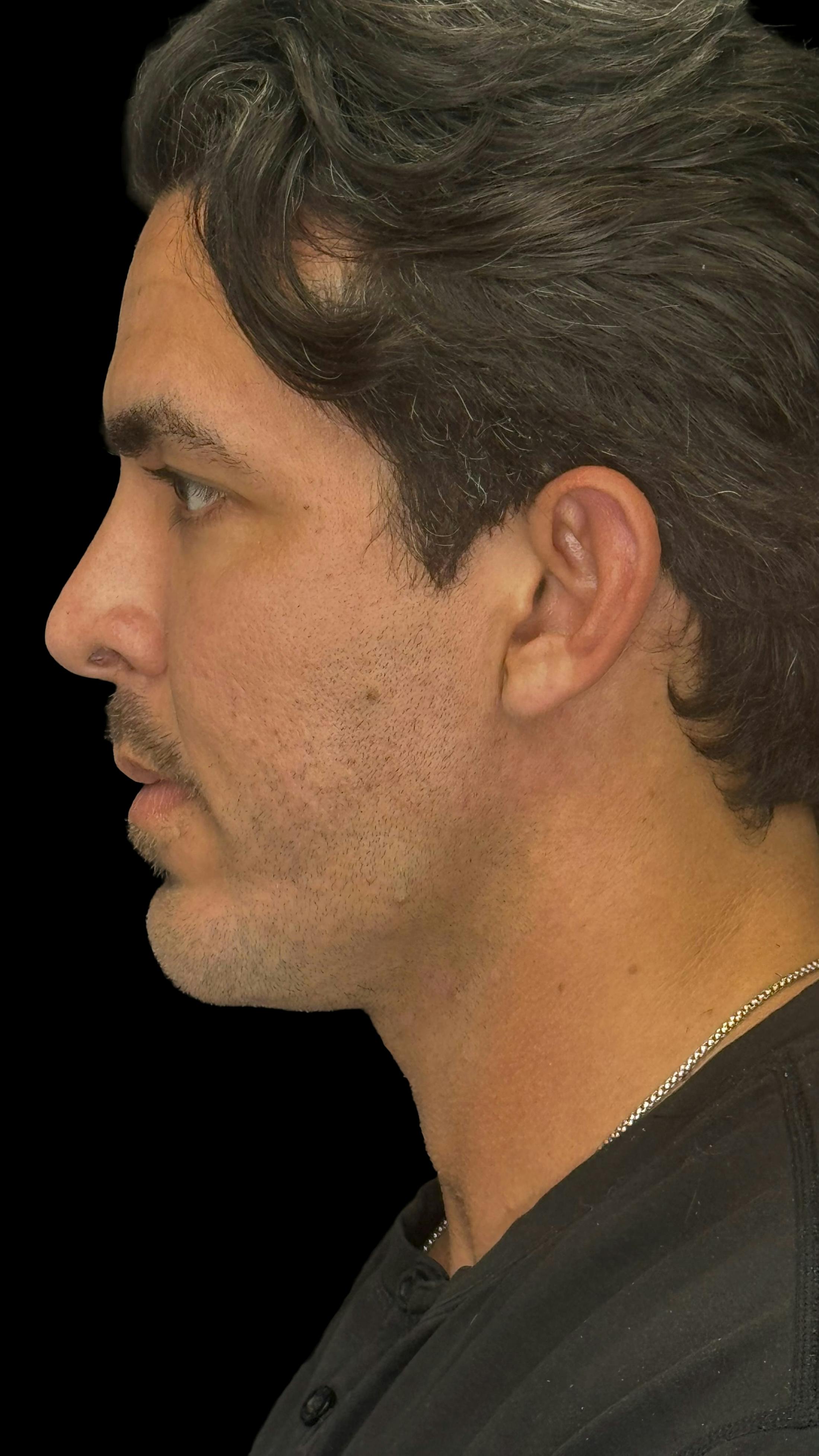 After image of a man