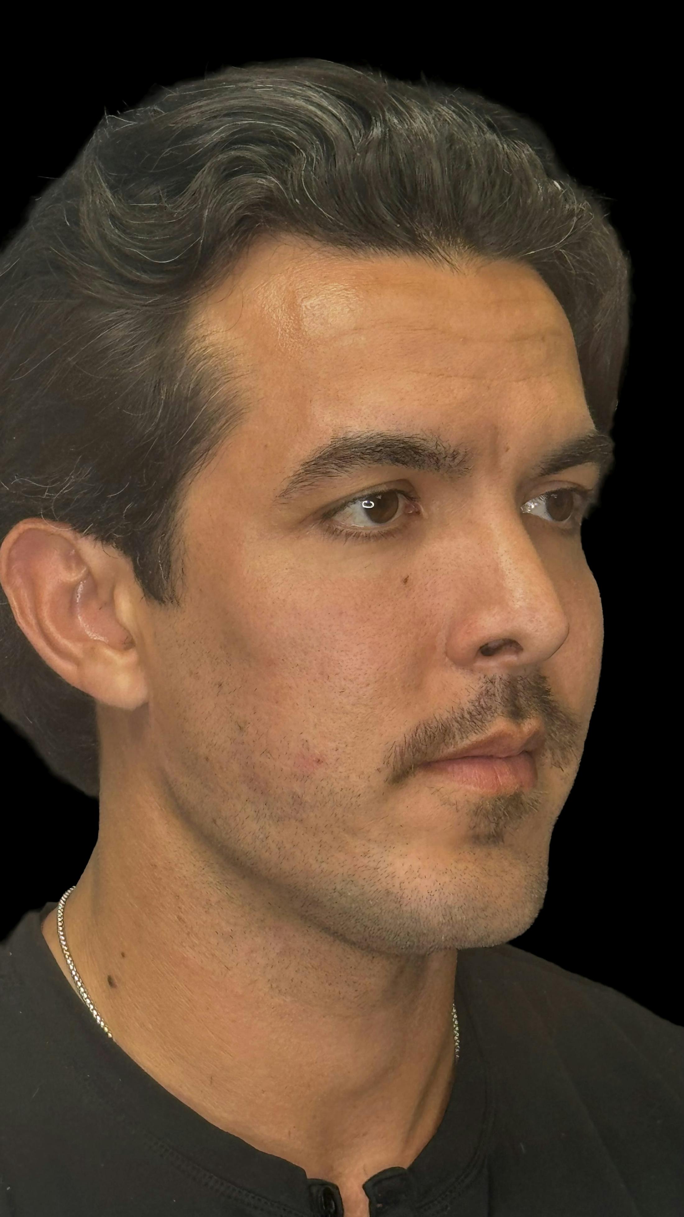 After image of a man