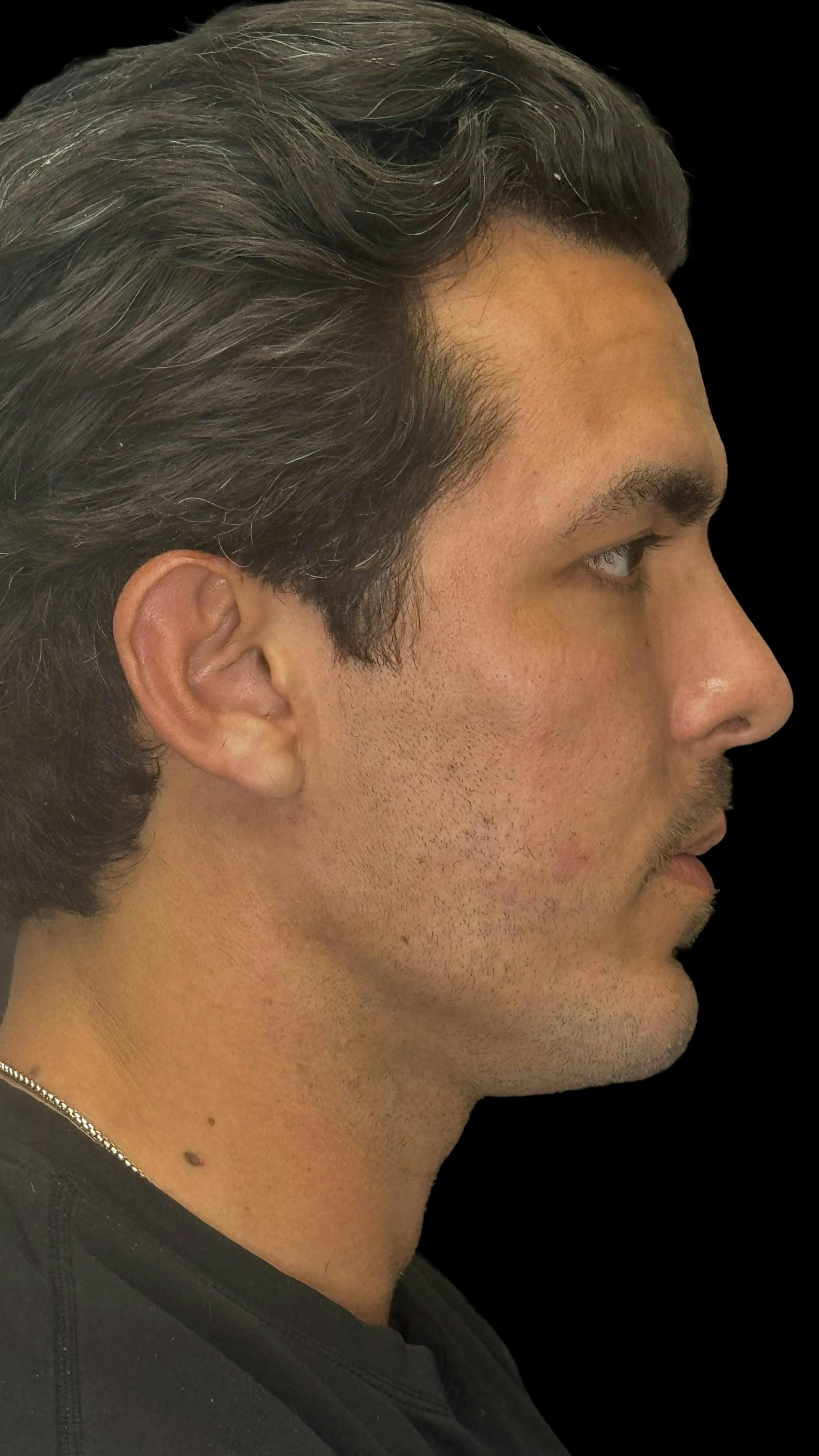 After image of a man