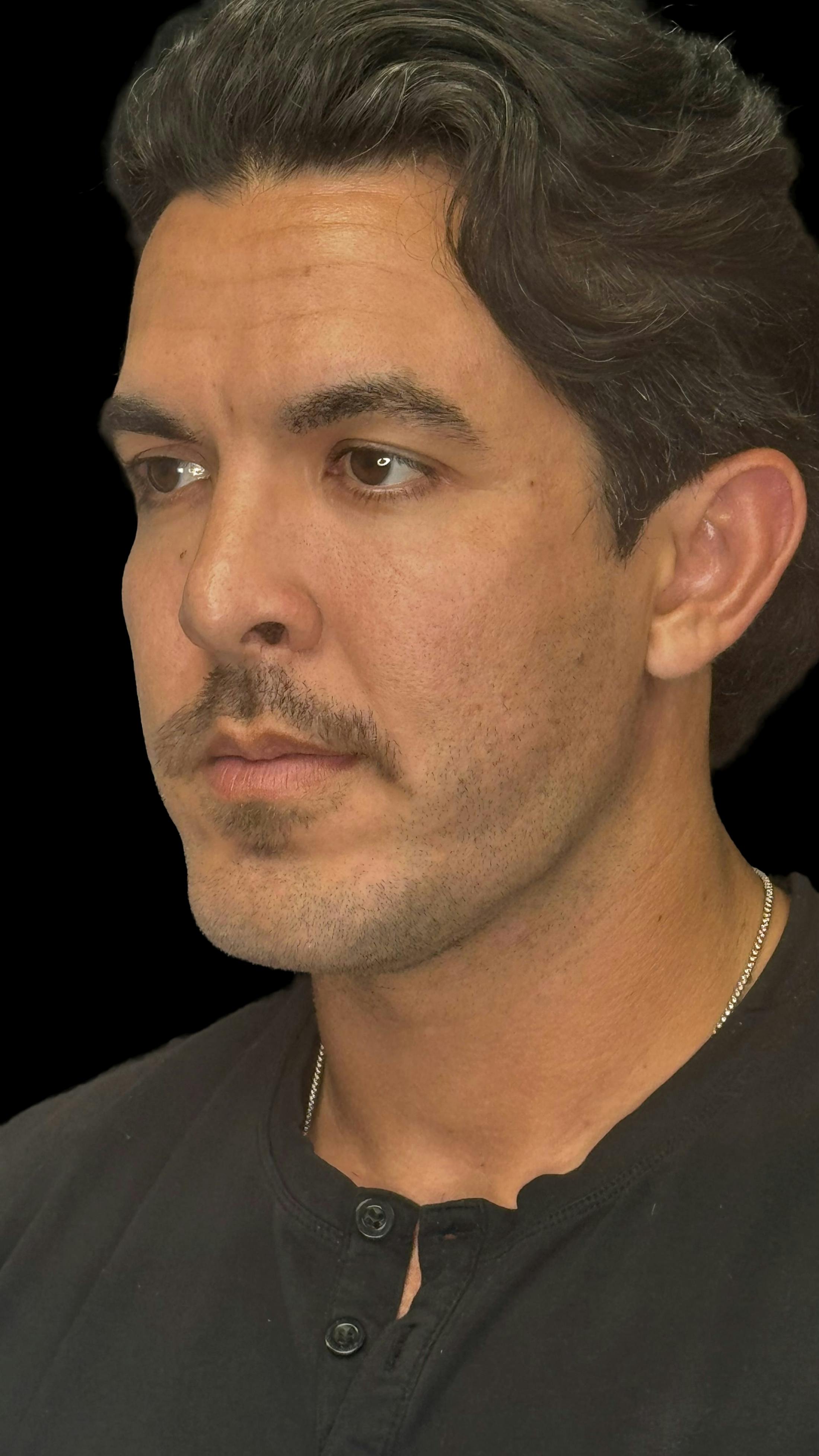 After image of a man