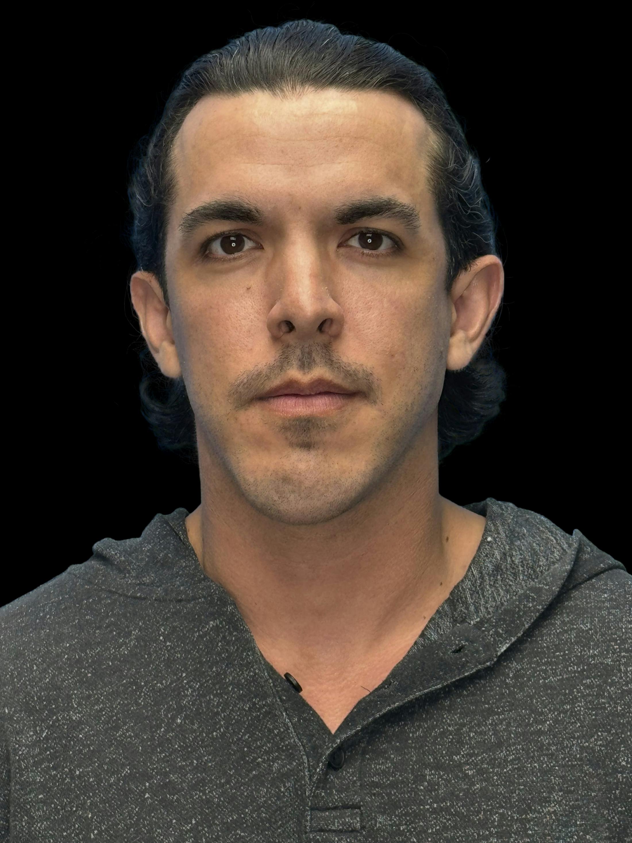 Before image of a man