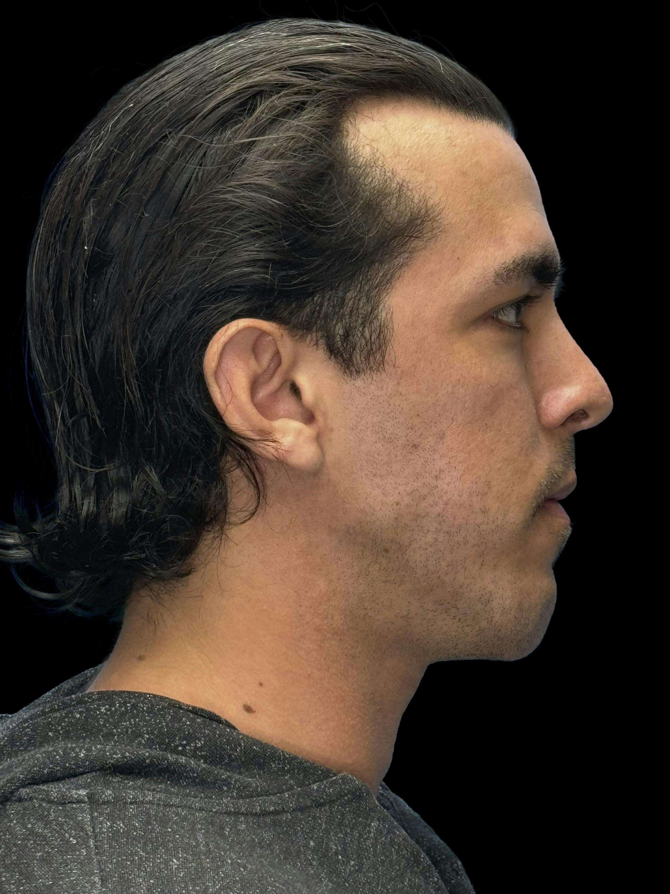 Before image of a man