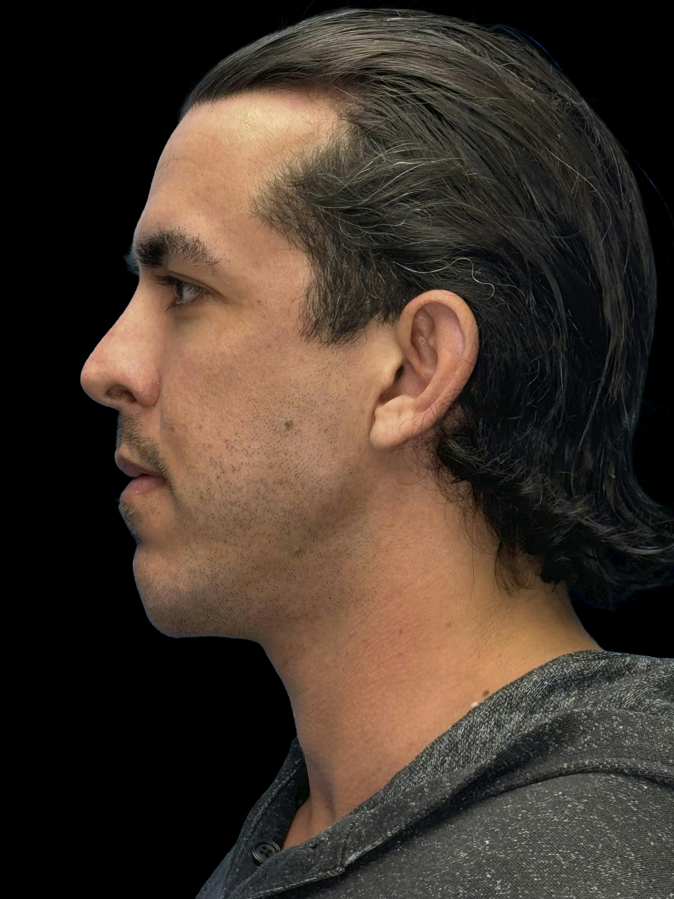 Before image of a man