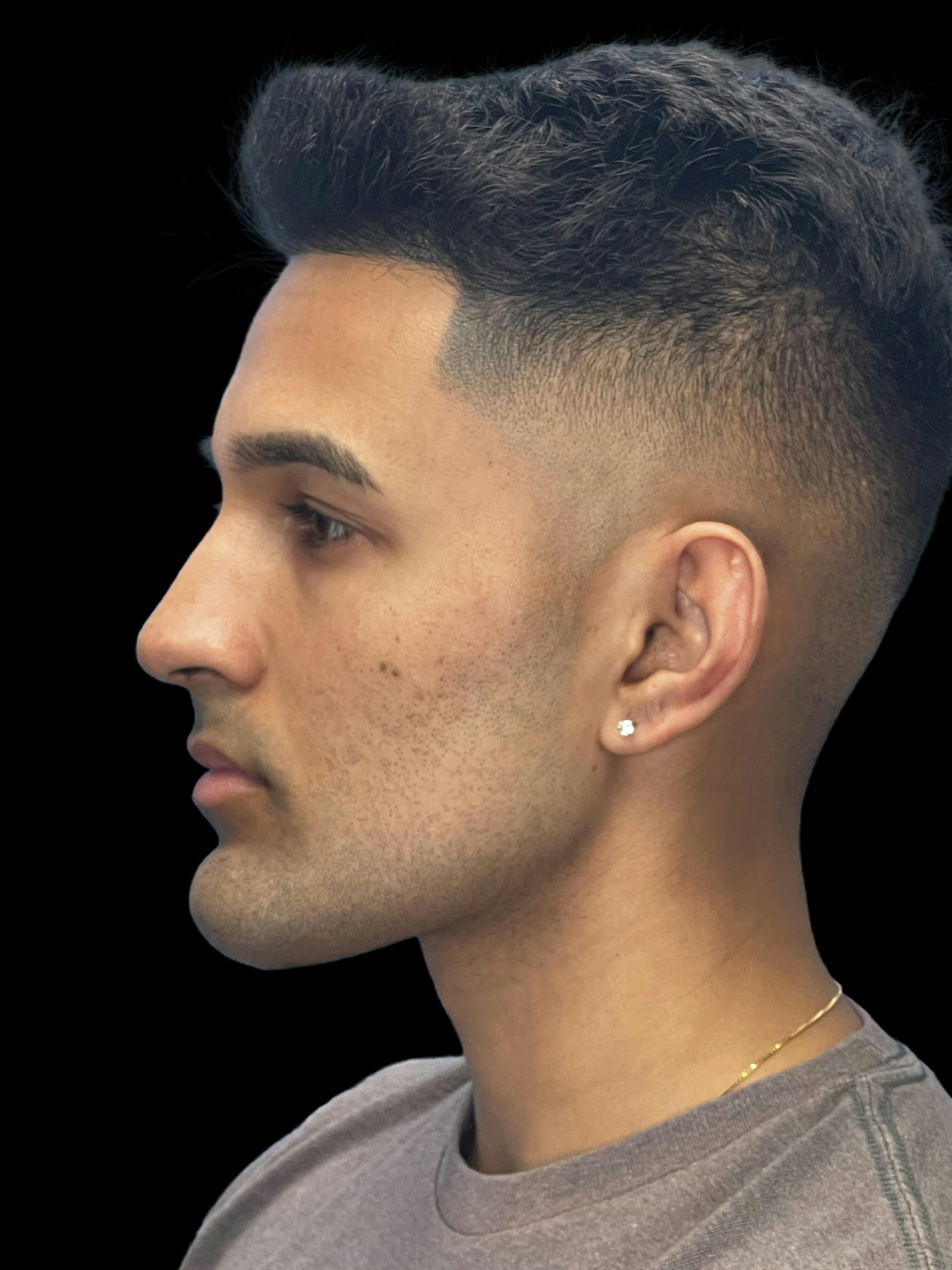 Before image of a man