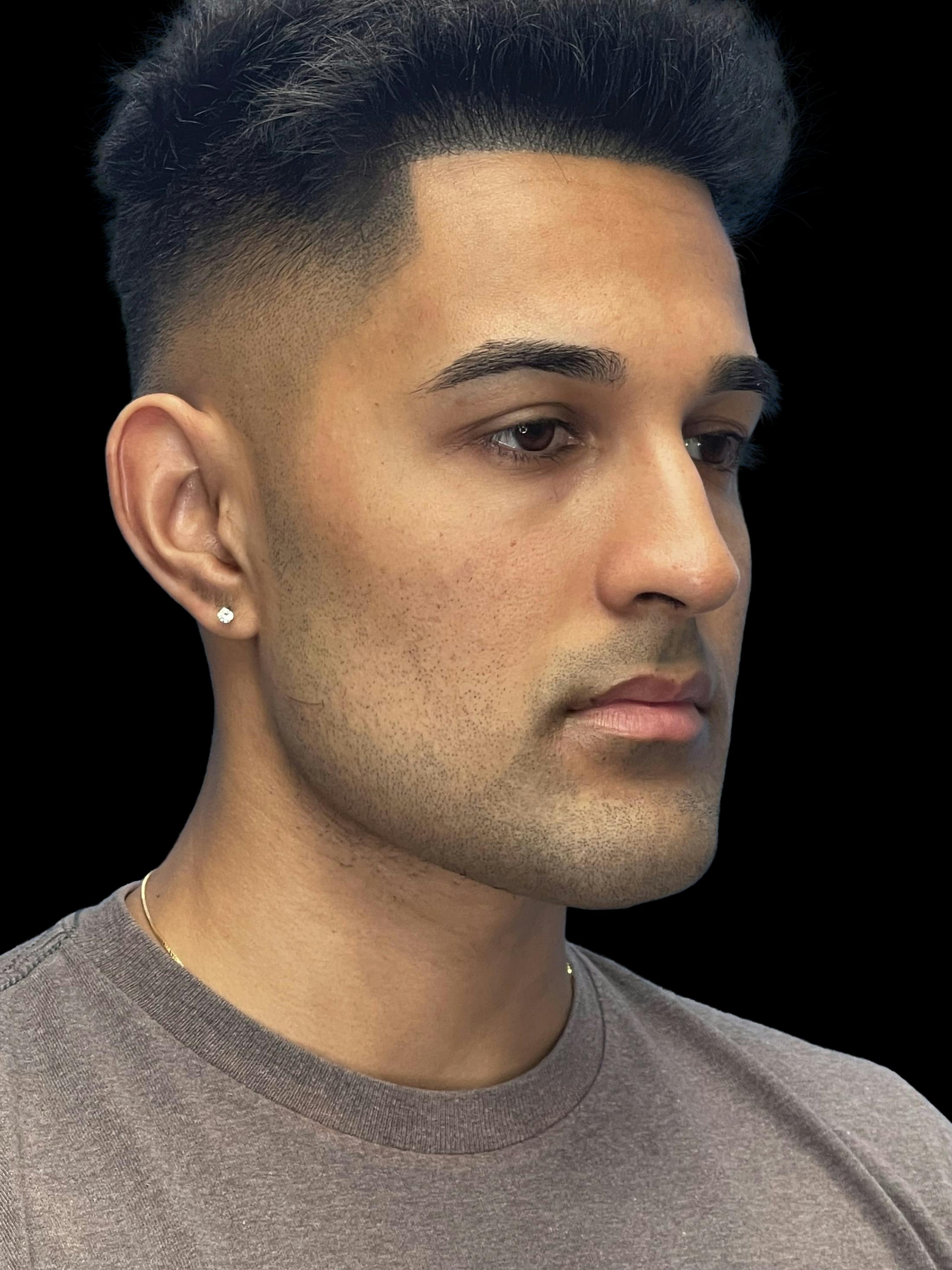 After image of a man