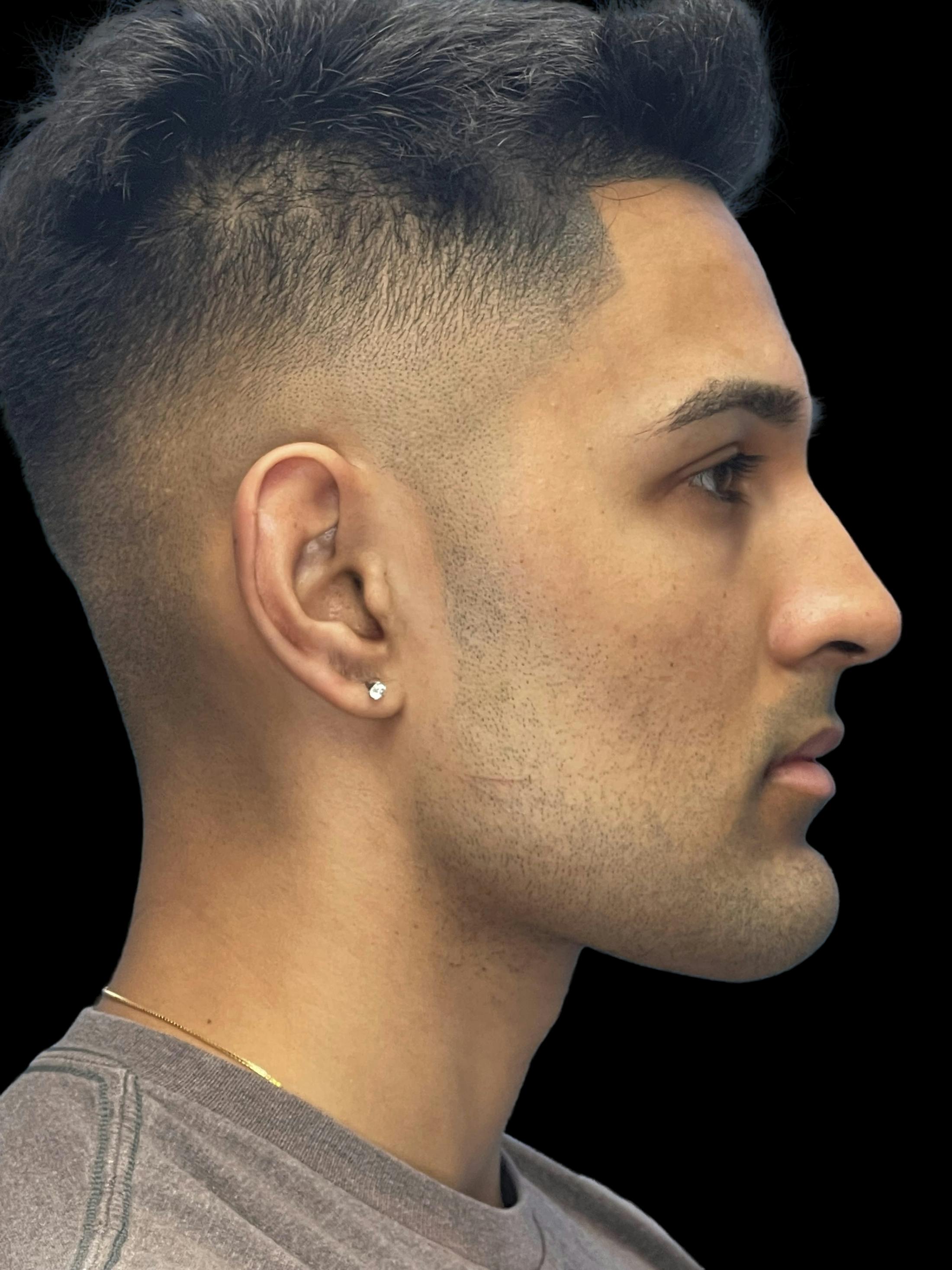 After image of a man