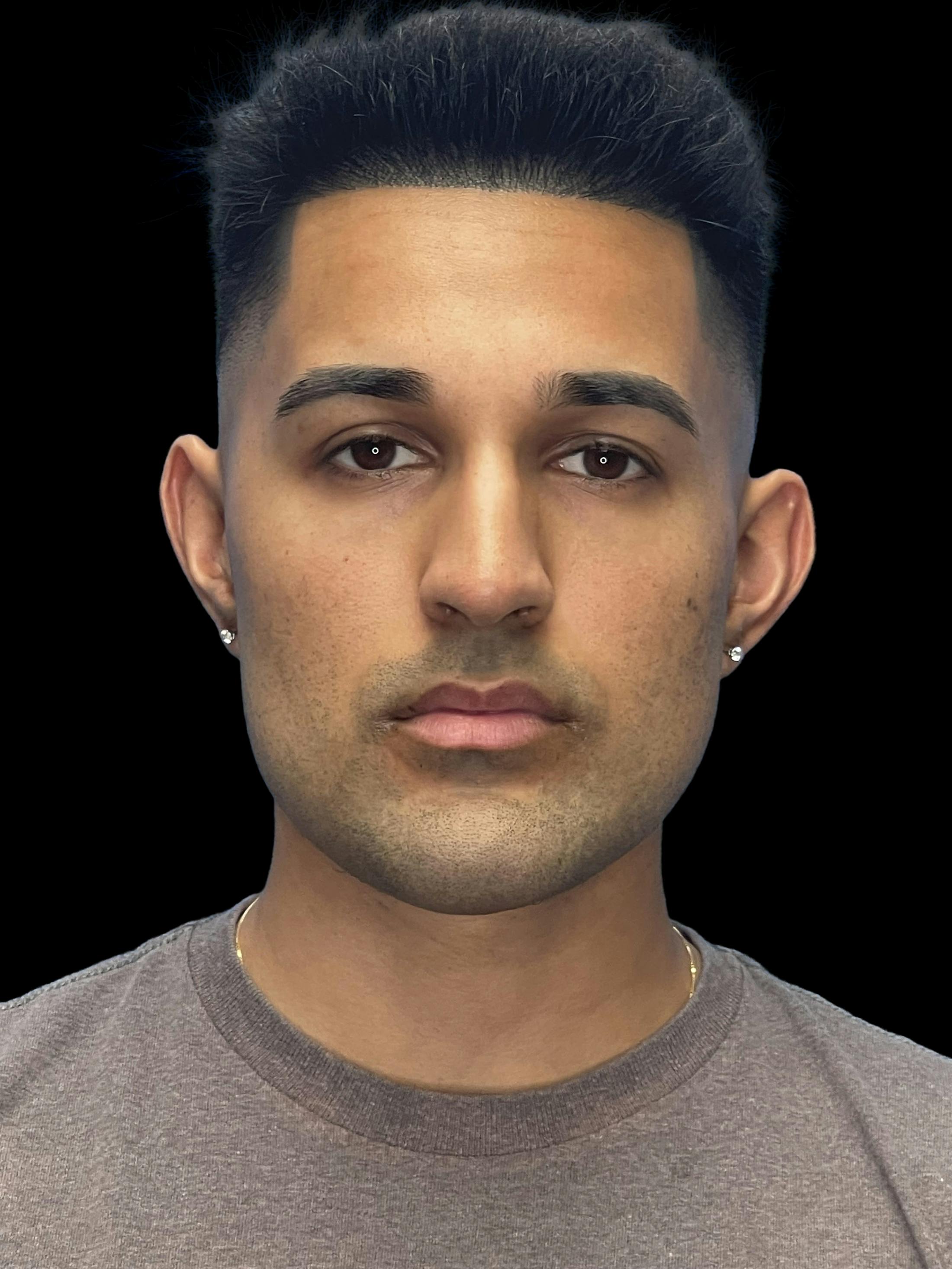 Before image of a man