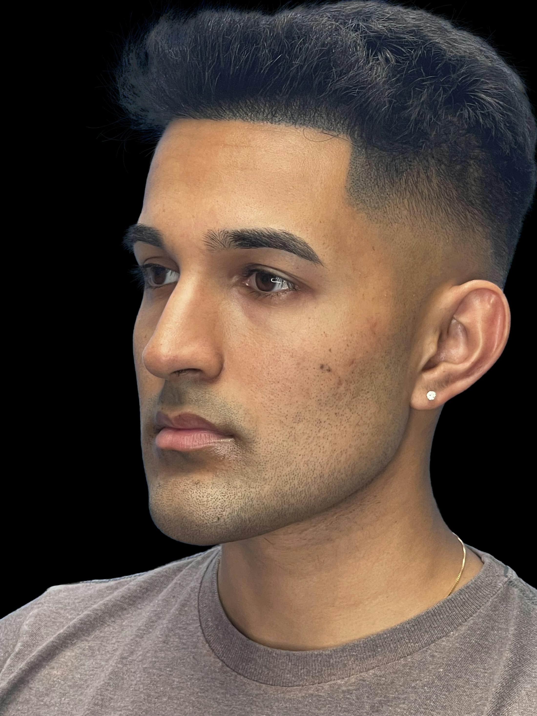 After image of a man