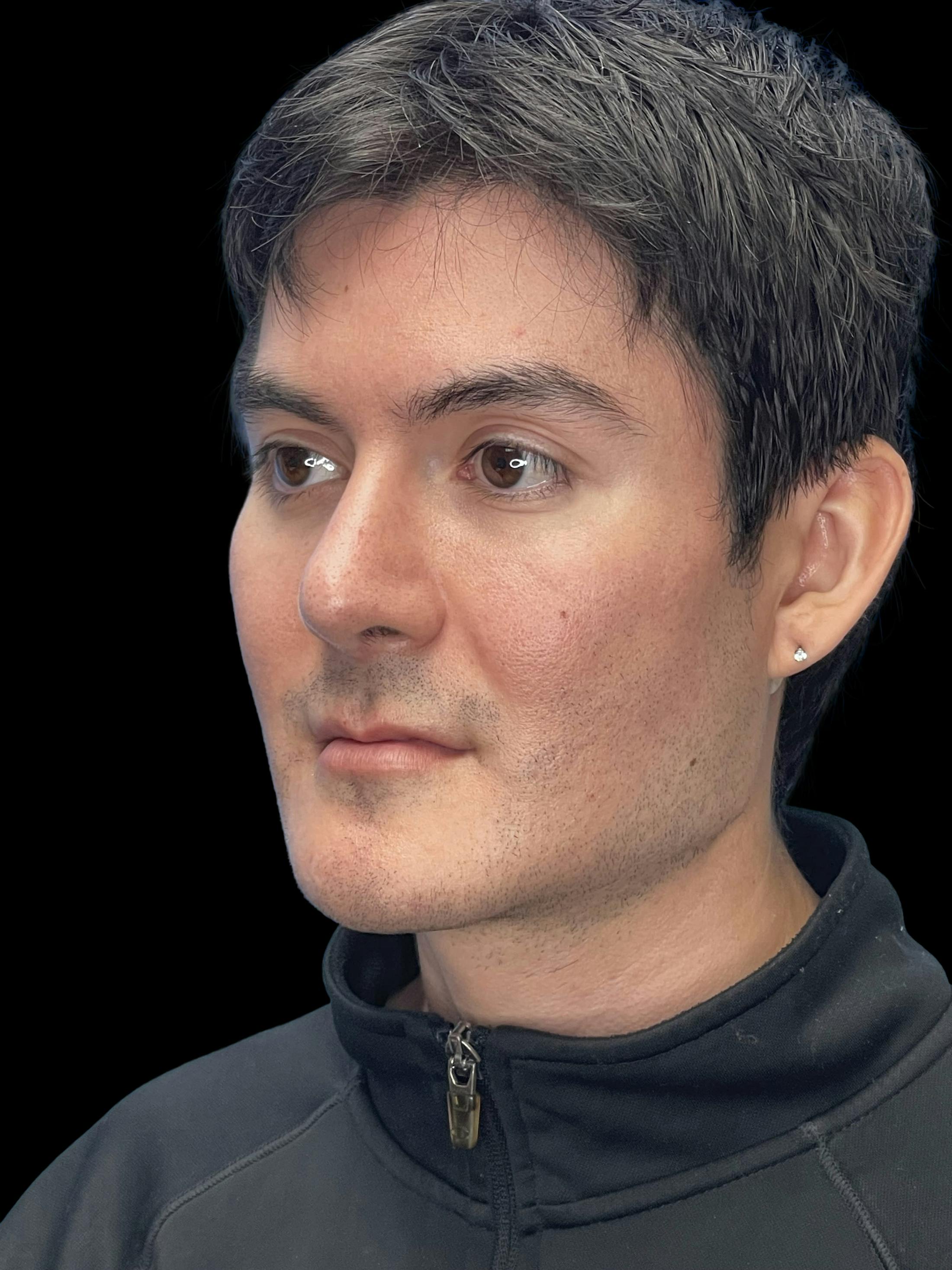 After image number 3