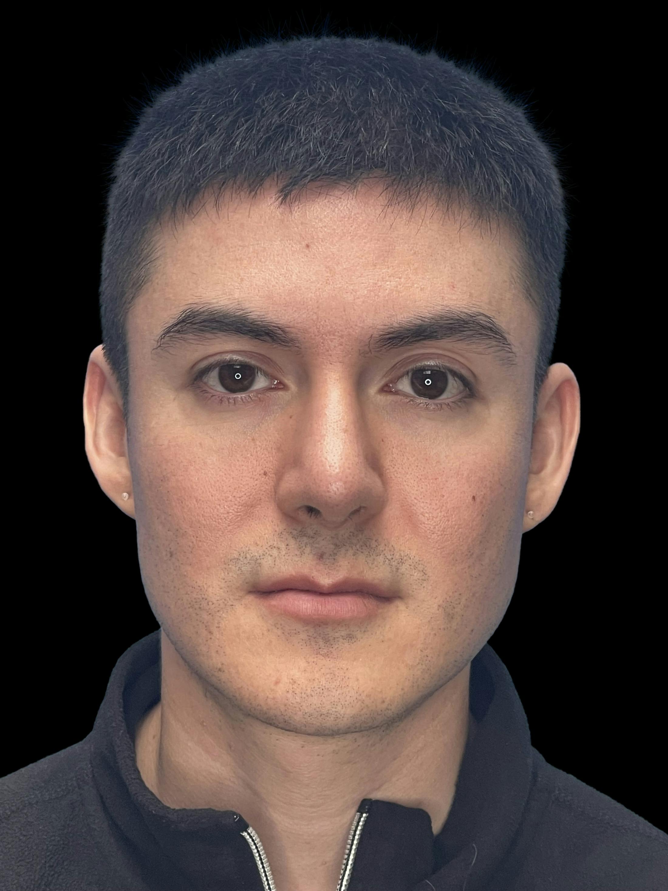 Before image number 2