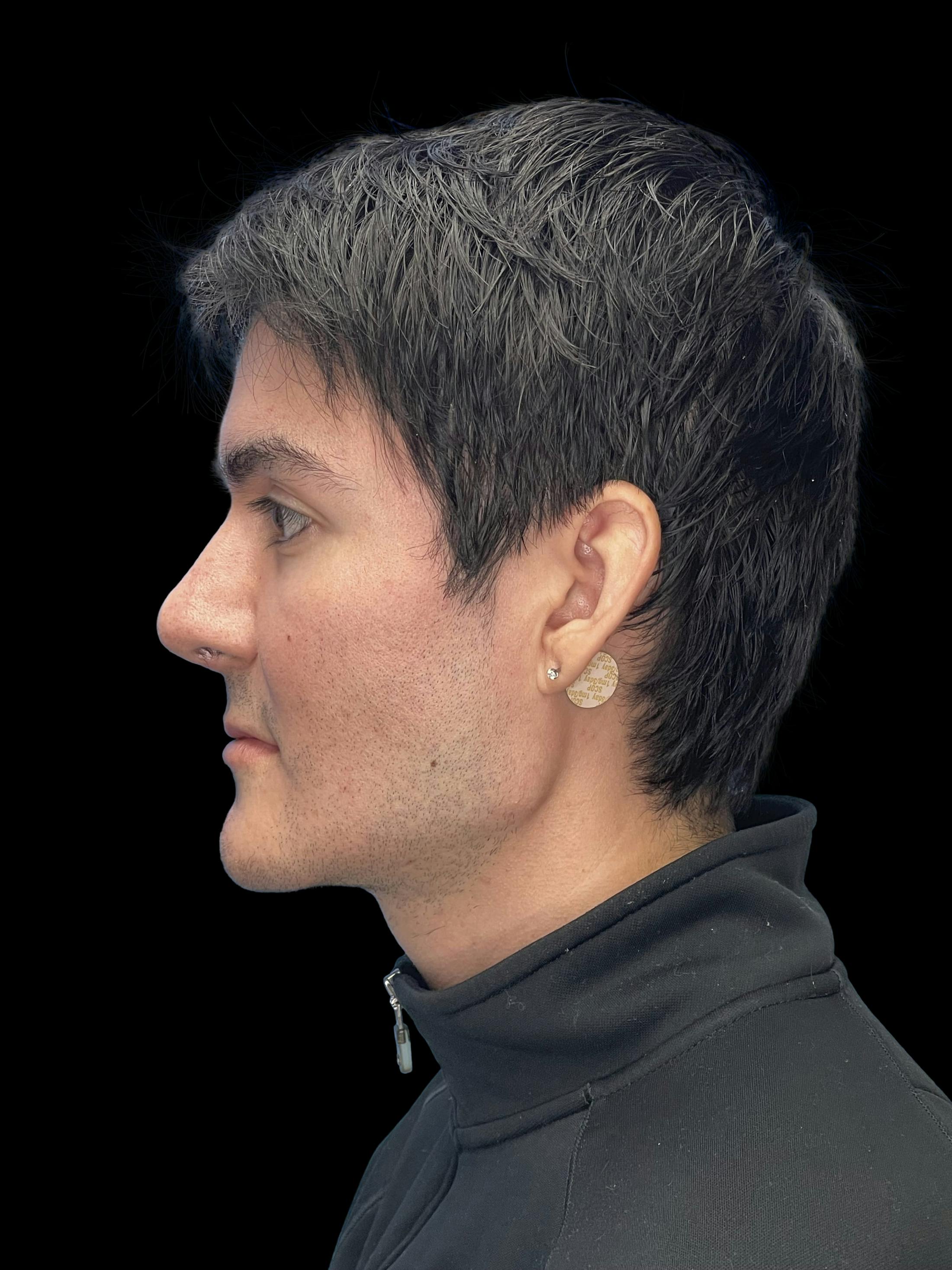 After image number 4