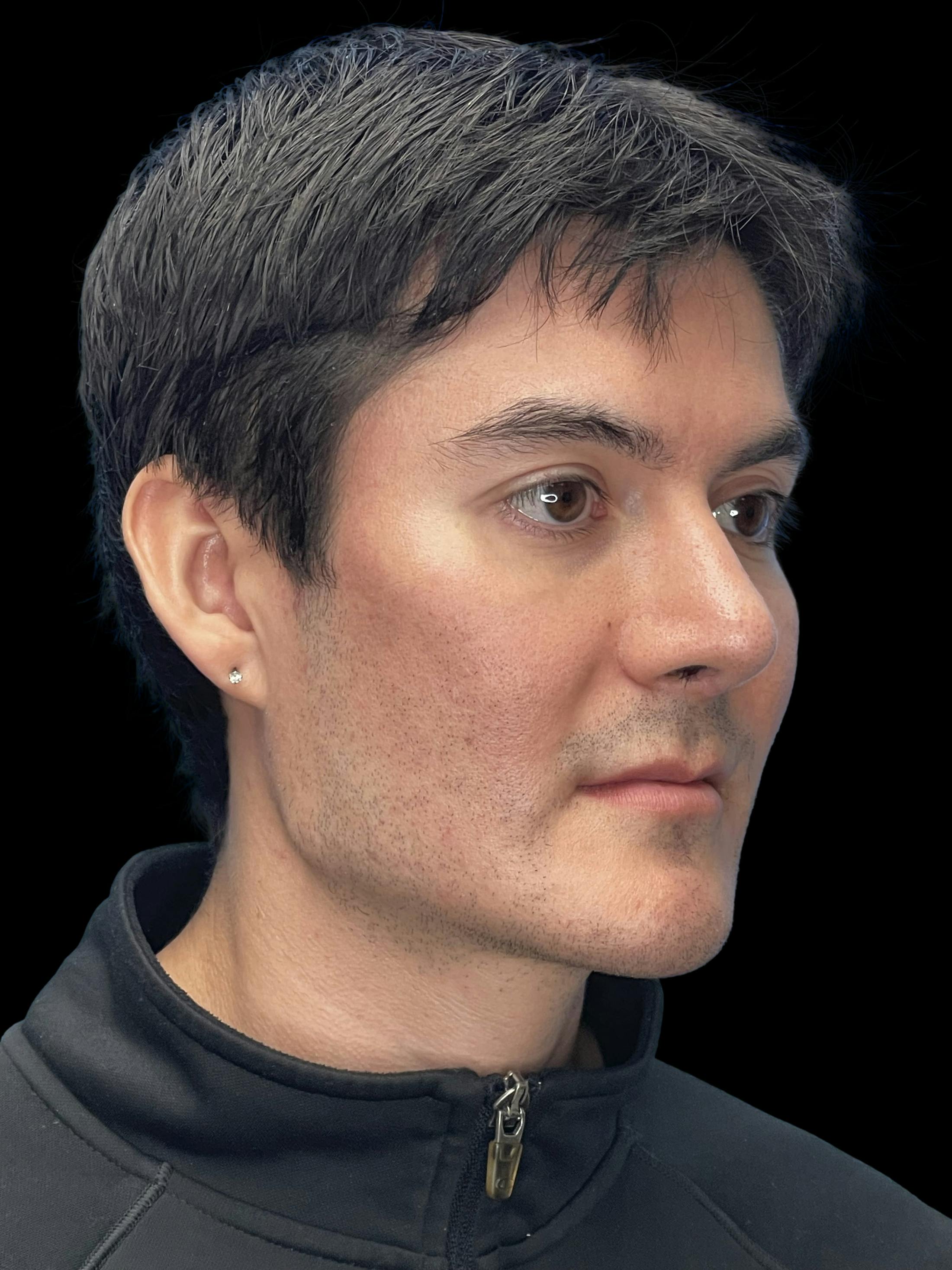 After image number 5