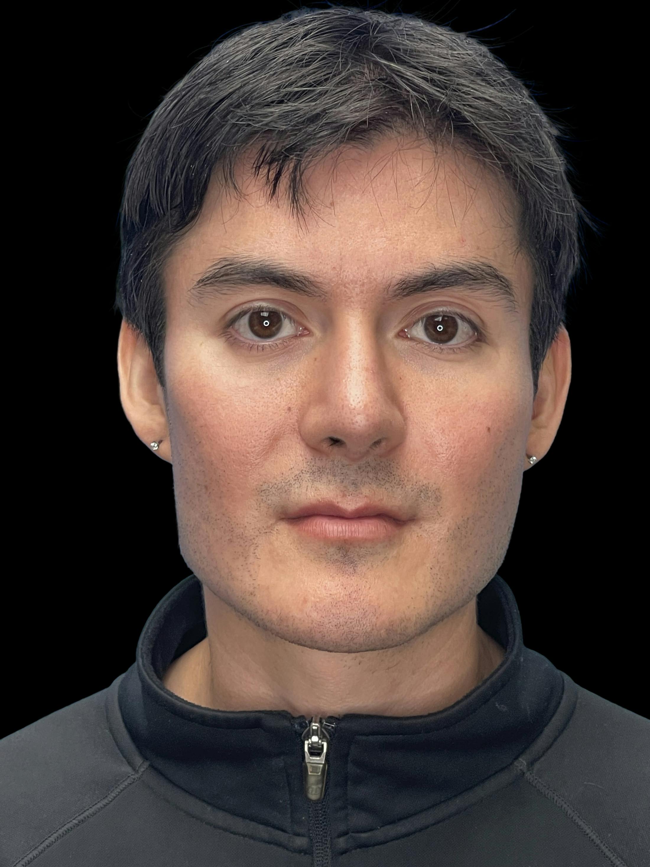 After image number 2