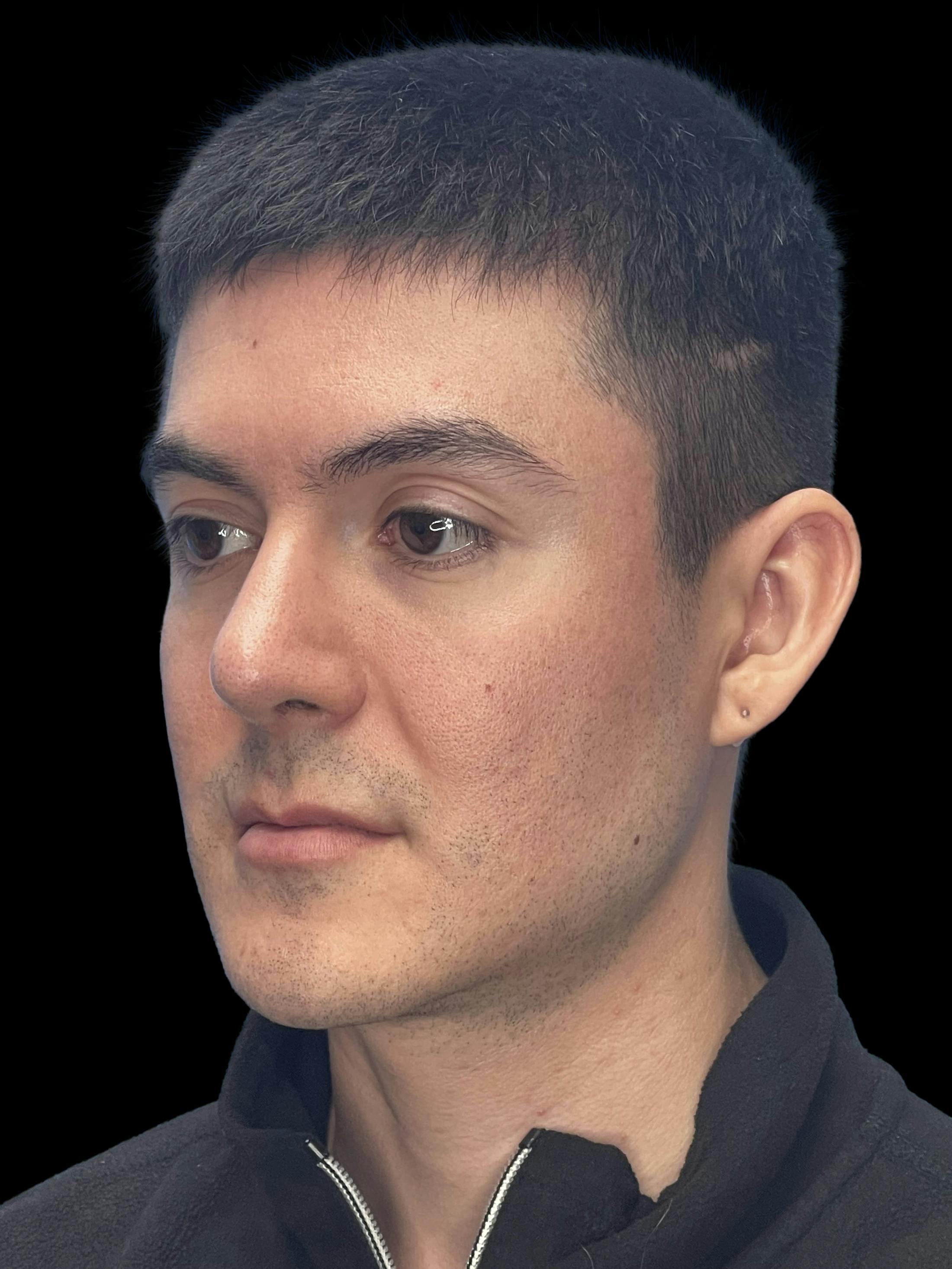 Before image number 3