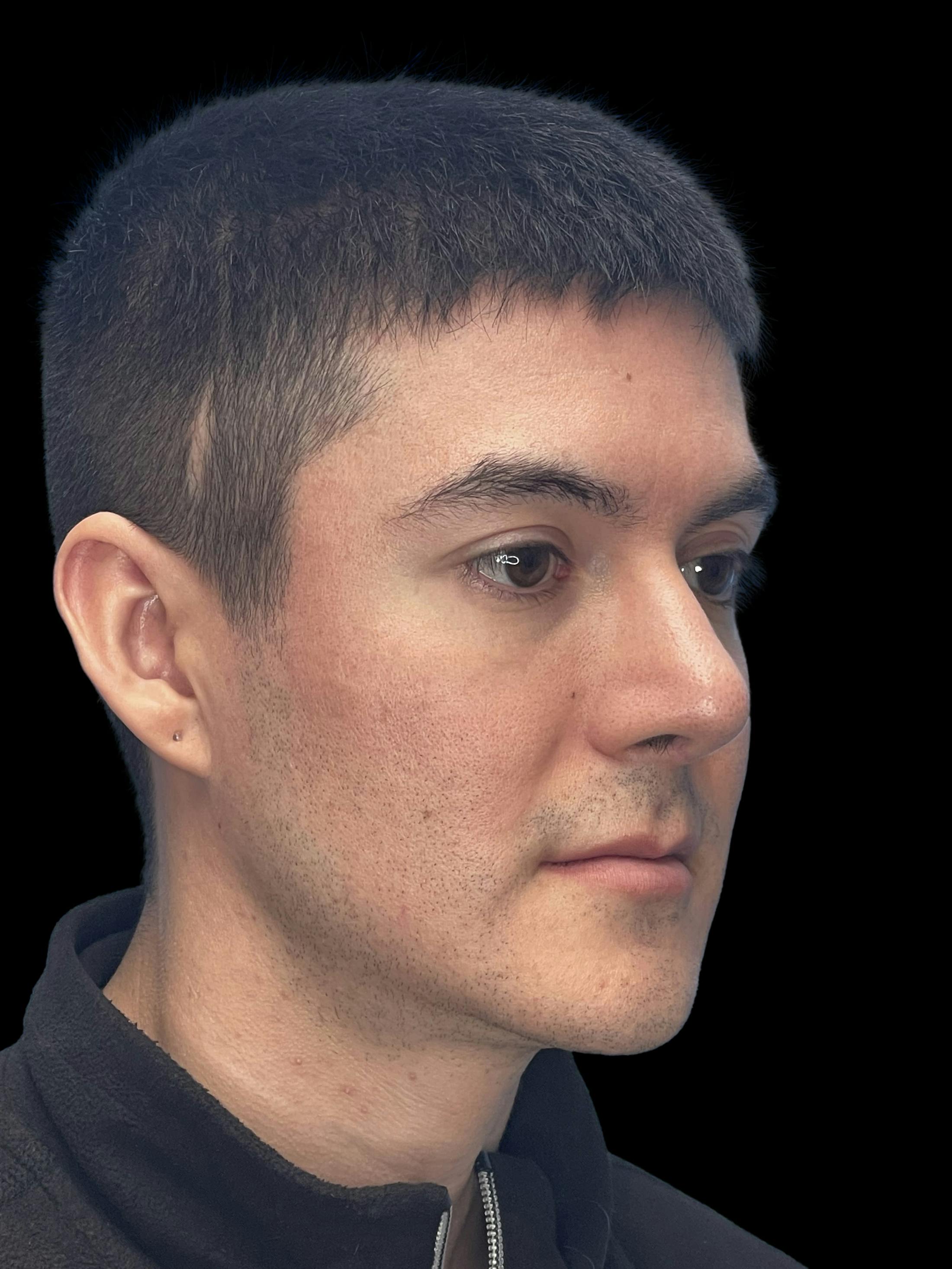 Before image number 5