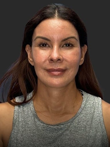 After image of a woman
