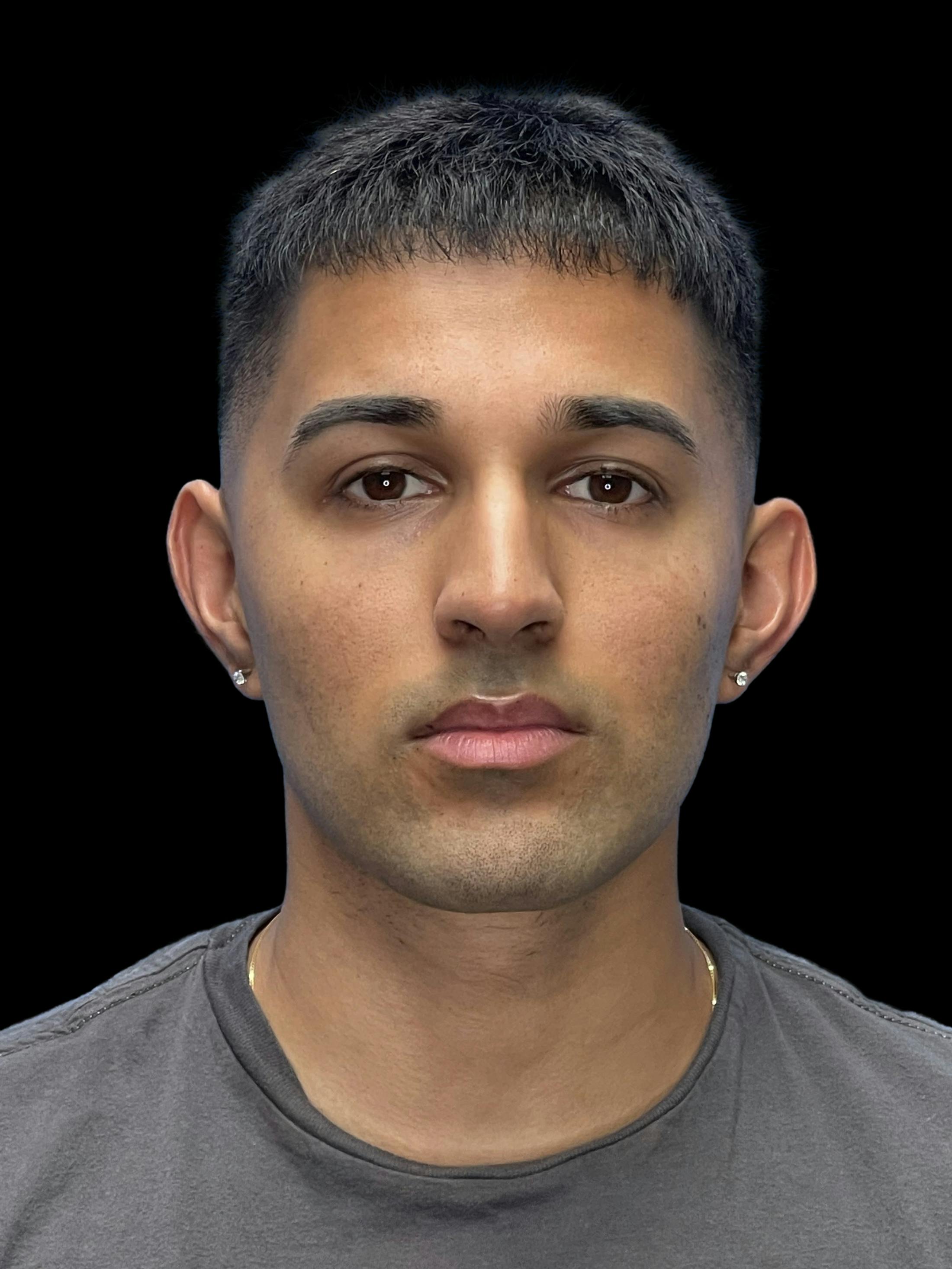 Before image of a man