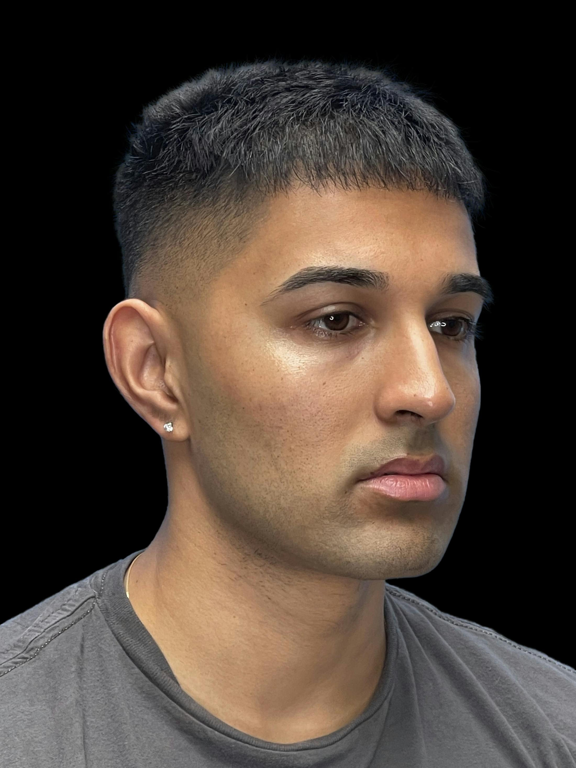 Before image of a man