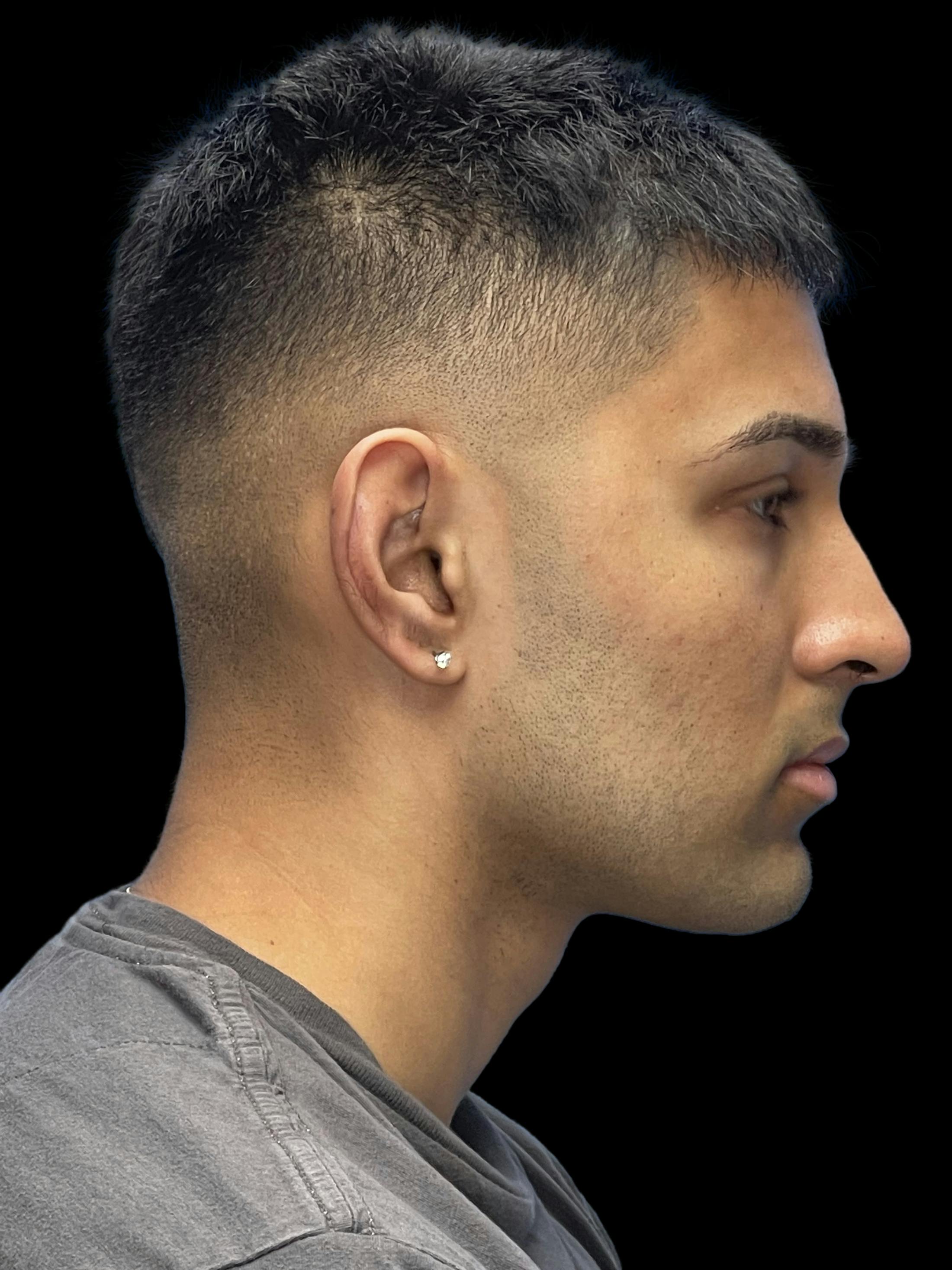 Before image of a man