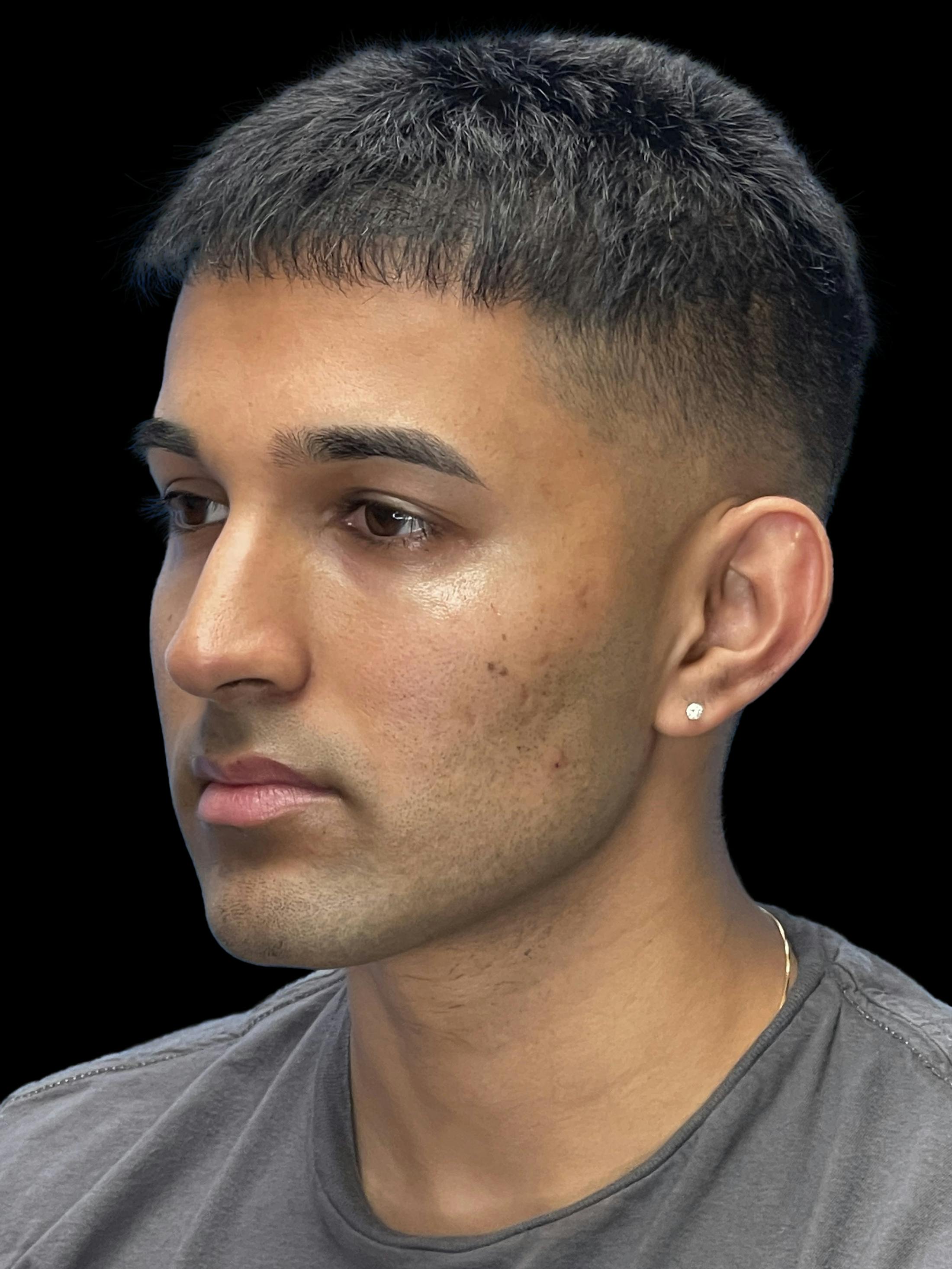 Before image of a man