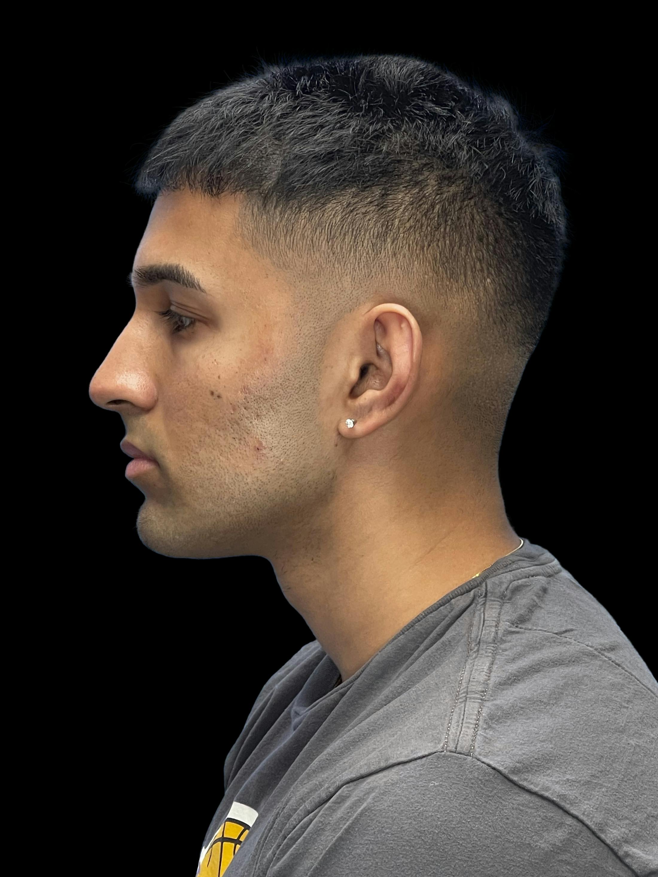 Before image of a man