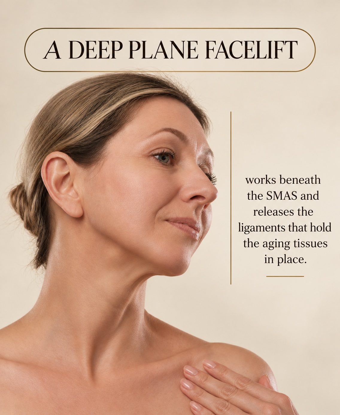 Woman showing facial aging areas addressed with a deep plane facelift